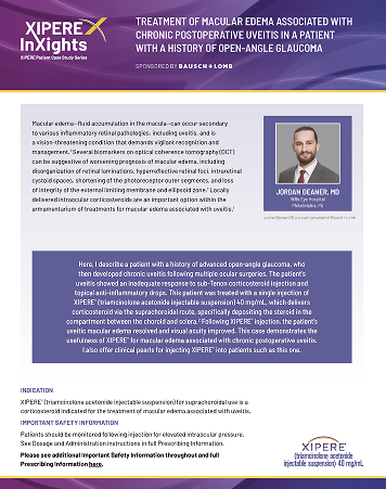 Treatment of Macular Edema